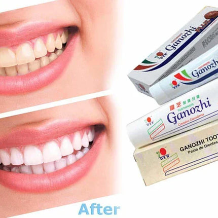 DXN GANOZHI TOOTHPASTE CONTAINS GANODERMA (150 GM)