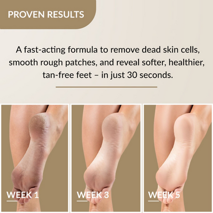 Fixderma Foobetik Foot Scrub Spray