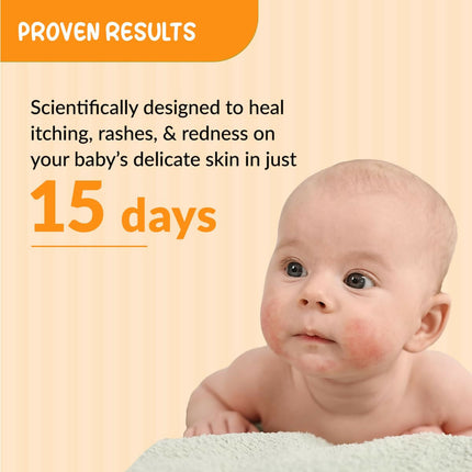 Fixderma Hoopoe Baby Anti-Itch Lotion - Soothing Relief for Itchy & Irritated Skin