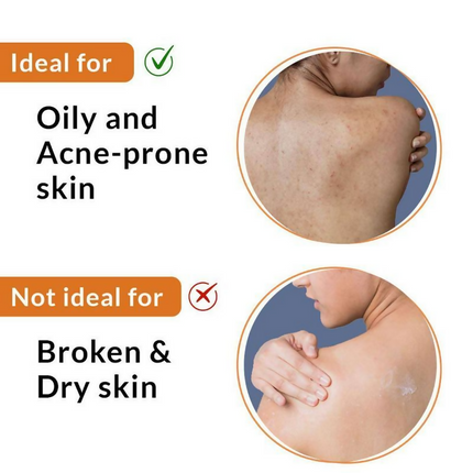 Fixderma 2% Salicylic Acid Salyzap Body Acne Spray