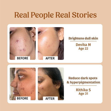 Vilvah Store Milk Drops Brightening Serum (Skin Brightening)