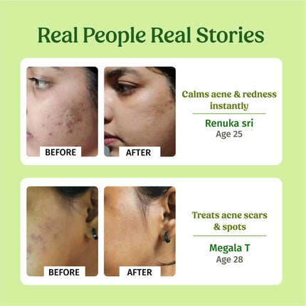 Vilvah Store Aloe Vera Gel (Multi-Purpose Skin & Hair Care)