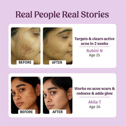 Vilvah Store Honey Fix Face wash (10% Raw Honey)