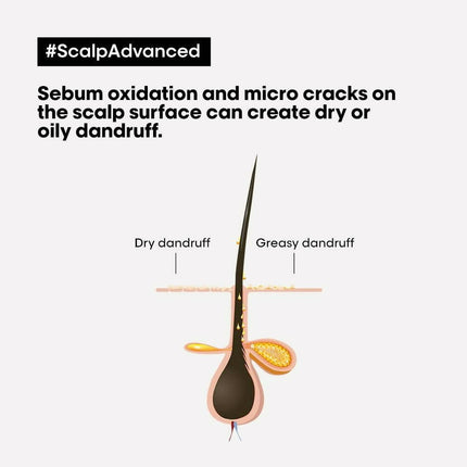 L'Oréal Paris Scalp Advanced Anti-Dandruff Dermo-Clarifier Shampoo & Liss Unlimited Hair Mask