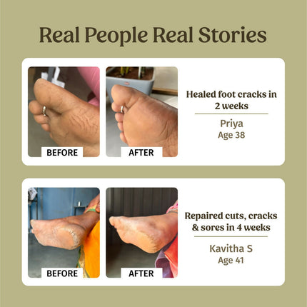 Vilvah Store Foot Cream (Treats Cracked Heels)