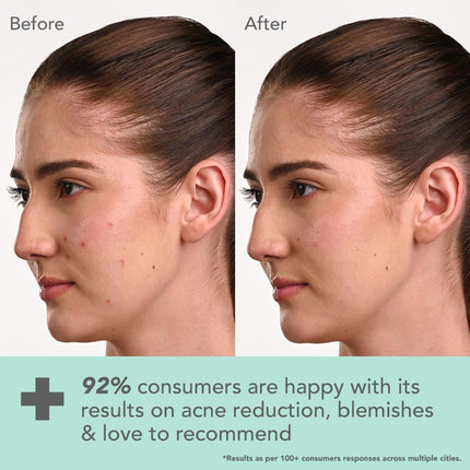 Lotus DermaBotanics Kojic Acid + Multi Berry Blemish-Free Face Wash, pH5.5, For Sensitive Skin