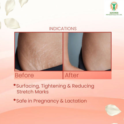 Adonis Strie Stretch Mark Cream