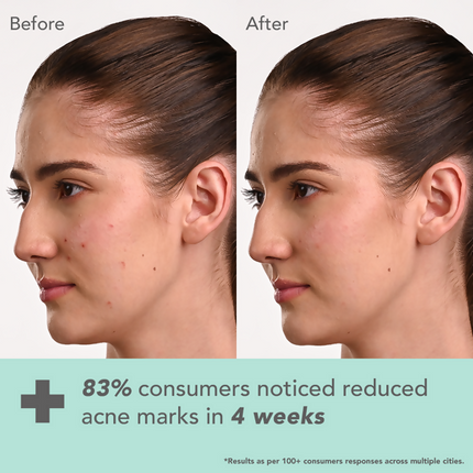 Lotus DermaBotanics Kojic acid + Multi Berry Face Serum