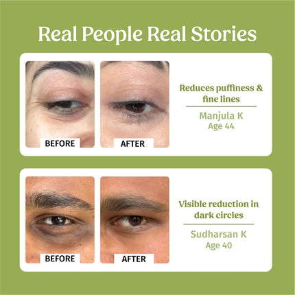 Vilvah Store Under Eye Cream (Dark Circle Control)