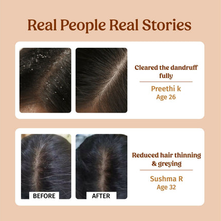 Vilvah Store Herbal Shampoo (Dandruff Control)